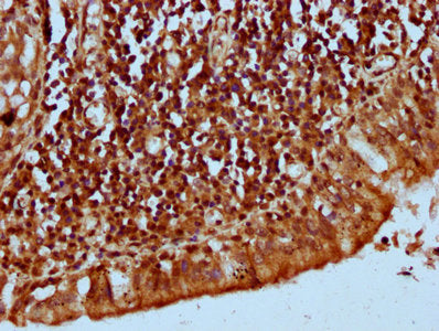 IHC image of KLHL20 Antibody diluted at 1:300 and staining in paraffin-embedded human lung tissue performed on a Leica BondTM system. After dewaxing and hydration, antigen retrieval was mediated by high pressure in a citrate buffer (pH 6.0). Section was blocked with 10% normal goat serum 30min at RT. Then primary antibody (1% BSA) was incubated at 4°C overnight. The primary is detected by a biotinylated secondary antibody and visualized using an HRP conjugated SP system.