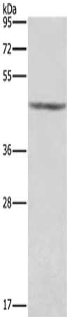 Gel: 8%SDS-PAGE, Lysate: 40 μg, Lane: Human placenta tissue , Primary antibody: KCNJ9 Antibody(KCNJ9 Antibody) at dilution 1/350, Secondary antibody: Goat anti rabbit IgG at 1/8000 dilution, Exposure time: 1 second