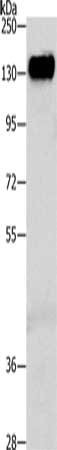 Gel: 8%SDS-PAGE, Lysate: 40 μg, Lane: Human liver cancer tissue, Primary antibody: CEACAM5 Antibody(CEACAM5 Antibody) at dilution 1/300, Secondary antibody: Goat anti rabbit IgG at 1/8000 dilution, Exposure time: 10 minutesRabbit anti-Human CEACAM5 Polyclonal Antibody