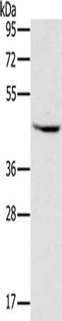 Gel: 8%SDS-PAGE, Lysate: 40 μg, Lane: Raji cells, Primary antibody: MVK Antibody(MVK Antibody) at dilution 1/300, Secondary antibody: Goat anti rabbit IgG at 1/8000 dilution, Exposure time: 2 secondsRabbit anti-Human MVK Polyclonal Antibody