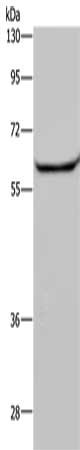 Gel: 8%SDS-PAGE, Lysate: 40 μg, Lane: Human testis tissue, Primary antibody: HACL1 Antibody(HACL1 Antibody) at dilution 1/200, Secondary antibody: Goat anti rabbit IgG at 1/8000 dilution, Exposure time: 30 secondsRabbit anti-Human HACL1 Polyclonal Antibody