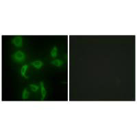 Immunofluorescence analysis of HepG2 cells, using IARS2 antibody.Rabbit anti-Human IARS2 Polyclonal Antibody
