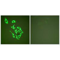 Immunofluorescence analysis of HepG2 cells, using HSP60 antibody.Rabbit anti-Human HSPD1 Polyclonal Antibody
