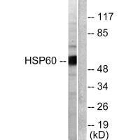 Western blot analysis of extracts from COLO205 cells, using HSP60 antibody.Rabbit anti-Human HSPD1 Polyclonal Antibody