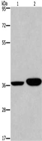 Gel: 6%SDS-PAGE,Lysate: 40 μg,Lane 1-2: Hela cells, A549 cells,Primary antibody: APAF1 Antibody(APAF1 Antibody) at dilution 1/350 dilution,Secondary antibody: Goat anti rabbit IgG at 1/8000 dilution,Exposure time: 5 minutesRabbit anti-Human APAF1 Polyclonal Antibody