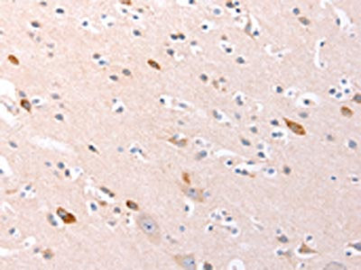 The image on the left is immunohistochemistry of paraffin-embedded Human brain tissue using the antibody Antibody) at dilution 1/20, on the right is treated with synthetic peptide. (Original magnification: ×200)Rabbit anti-Human RALA Polyclonal Antibody