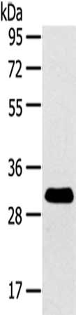 Gel: 8%SDS-PAGE,Lysate: 40 μg,,Primary antibody: RALA Antibody(RalA Antibody) at dilution 1/200 dilution,Secondary antibody: Goat anti rabbit IgG at 1/8000 dilution,Exposure time: 2 minutesRabbit anti-Human RALA Polyclonal Antibody