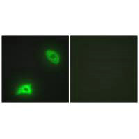Immunofluorescence analysis of HeLa cells, using DUSP6 antibody.Rabbit anti-Human DUSP6 Polyclonal Antibody