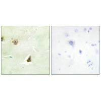 Immunohistochemistry analysis of paraffin-embedded human brain tissue, using DUSP6 antibody.Rabbit anti-Human DUSP6 Polyclonal Antibody