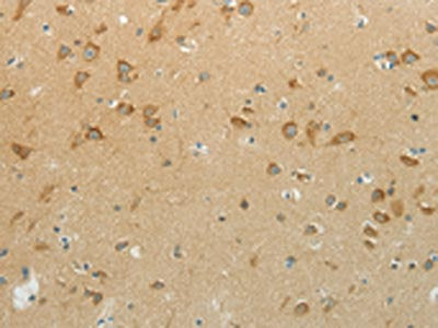 The image on the left is immunohistochemistry of paraffin-embedded Human brain  tissue using NDRG3 Antibody(NDRG3 Antibody) at dilution 1/70, on the right is treated with synthetic peptide. (Original magnification: ×200)Rabbit anti-Human NDRG3 Polyclonal Antibody