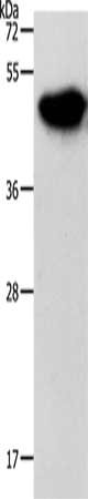 Gel: 12%SDS-PAGE, Lysate: 30 μg, Lane: Mouse brain tissue, Primary antibody: NDRG3 Antibody(NDRG3 Antibody) at dilution 1/1050, Secondary antibody: Goat anti rabbit IgG at 1/8000 dilution, Exposure time: 2 secondsRabbit anti-Human NDRG3 Polyclonal Antibody