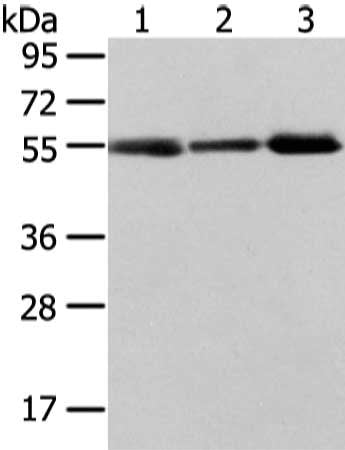 Gel: 8%SDS-PAGE, Lysate: 40 μg, Lane 1-3: Human normal stomach tissue, human liver cancer and thyroid cancer tissue, Primary antibody: XKRX Antibody(XKRX Antibody) at dilution 1/400 dilution, Secondary antibody: Goat anti rabbit IgG at 1/8000 dilution, Exposure time: 2 minutesRabbit anti-Human XKRX Polyclonal Antibody