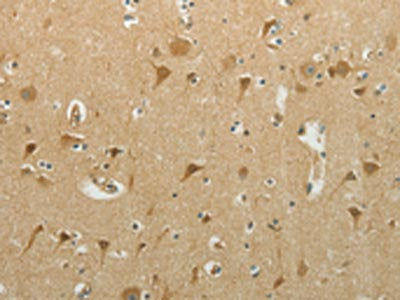 The image on the left is immunohistochemistry of paraffin-embedded Human brain tissue using the antibody Antibody) at dilution 1/40, on the right is treated with synthetic peptide. (Original magnification: ×200)