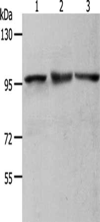 Gel: 8%SDS-PAGE, Lysate: 50 μg, Lane 1-3: NIH/3T3 cells, Hela cells, K562 cells, Primary antibody: MCM4 Antibody(MCM4 Antibody) at dilution 1/700, Secondary antibody: Goat anti rabbit IgG at 1/8000 dilution, Exposure time: 10 seconds