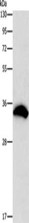 Gel: 15%SDS-PAGE, Lysate: 40 μg, Lane: 293T cells, Primary antibody: CDCA8 Antibody(CDCA8 Antibody) at dilution 1/800, Secondary antibody: Goat anti rabbit IgG at 1/8000 dilution, Exposure time: 1 secondRabbit anti-Human CDCA8 Polyclonal Antibody