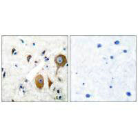 Immunohistochemical analysis of paraffin-embedded human brain tissue using GluR8 antibody.Rabbit anti-Human GRM8 Polyclonal Antibody