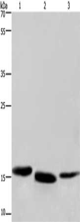 Gel: 10%SDS-PAGE, Lysate: 40 μg, Lane 1-3: Human kidney cancer tissue, mouse liver tissue, human bladder carcinoma tissue, Primary antibody: CYB5A Antibody(CYB5A Antibody) at dilution 1/300, Secondary antibody: Goat anti rabbit IgG at 1/8000 dilution, Exposure time: 1 minuteRabbit anti-Human CYB5A Polyclonal Antibody