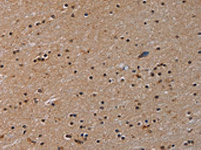 The image on the left is immunohistochemistry of paraffin-embedded Human brain  tissue using PARP8 Antibody(PARP8 Antibody) at dilution 1/40, on the right is treated with synthetic peptide. (Original magnification: ×200)Rabbit anti-Human PARP8 Polyclonal Antibody