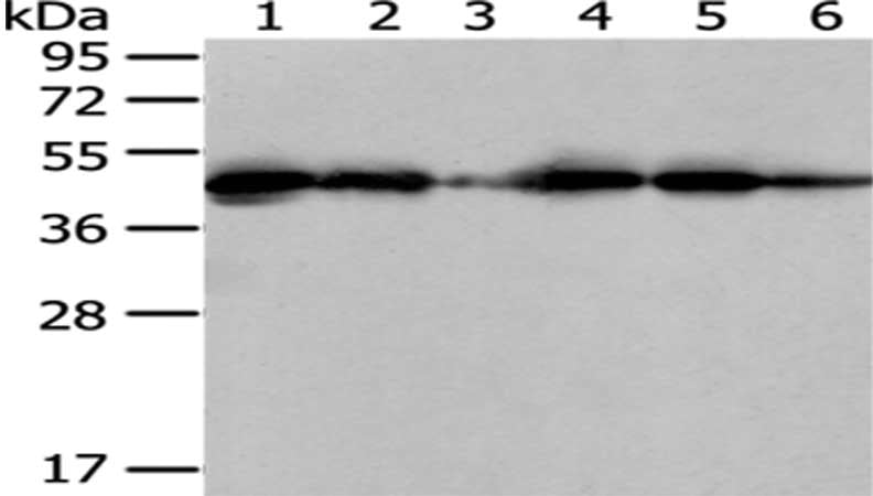 Gel: 8%SDS-PAGE, Lysate: 40 μg, Lane 1-6: 231, hela, hepg2, A431, K562 and Raji cell, Primary antibody: ERP44 Antibody(ERP44 Antibody) at dilution 1/400 dilution, Secondary antibody: Goat anti rabbit IgG at 1/8000 dilution, Exposure time: 20 secondsRabbit anti-Human ERP44 Polyclonal Antibody