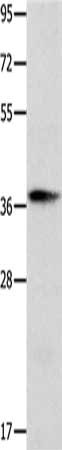 Gel: 10%SDS-PAGE, Lysate: 40 μg, Lane: NIH/3T3 cells, Primary antibody: CTSV Antibody(CTSV Antibody) at dilution 1/600, Secondary antibody: Goat anti rabbit IgG at 1/8000 dilution, Exposure time: 1 minuteRabbit anti-Human CTSV Polyclonal Antibody