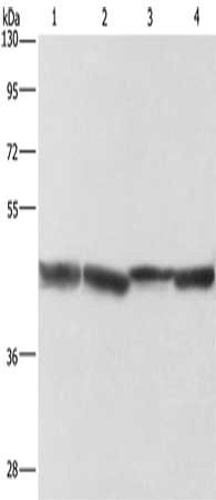 Gel: 10%SDS-PAGE, Lysate: 40 μg, Lane 1-4: human fetal liver tissue, Human liver cancer tissue, mouse liver tissue, human hepatocellular carcinoma tissue, Primary antibody: ADH1A Antibody(ADH1A Antibody) at dilution 1/250, Secondary antibody: Goat anti rabbit IgG at 1/8000 dilution, Exposure time: 10 secondsRabbit anti-Human ADH1A Polyclonal Antibody