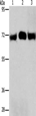 Gel: 8%SDS-PAGE, Lysate: 40 μg, Lane 1-3: Hela cells, A549 cells, human liver cancer tissue, Primary antibody: RPN1 Antibody(RPN1 Antibody) at dilution 1/350, Secondary antibody: Goat anti rabbit IgG at 1/8000 dilution, Exposure time: 30 secondsRabbit anti-Human RPN1 Polyclonal Antibody