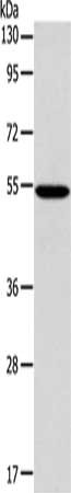 Gel: 10%SDS-PAGE, Lysate: 40 μg, Lane: 293T cells, Primary antibody: ERG Antibody(ERG Antibody) at dilution 1/650, Secondary antibody: Goat anti rabbit IgG at 1/8000 dilution, Exposure time: 2 minutesRabbit anti-Human ERG Polyclonal Antibody