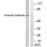 Western blot analysis of extracts from HepG2 cells, treated with Adriamycin (0.5uM, 5hours), using Vimentin antibody.Rabbit anti-Human VIM Polyclonal Antibody