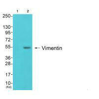 Western blot analysis of extracts from 293 cells (Lane 2), using Vimentin antiobdy. The lane on the left is treated with synthesized peptide.Rabbit anti-Human VIM Polyclonal Antibody