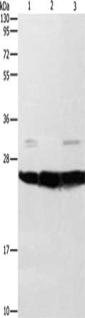 Gel: 10%SDS-PAGE, Lysate: 40 μg, Lane 1-3: Mouse liver tissue, Mouse brain tissue, A549 cells, Primary antibody: SIGMAR1 Antibody(SIGMAR1 Antibody) at dilution 1/310, Secondary antibody: Goat anti rabbit IgG at 1/8000 dilution, Exposure time: 1 secondRabbit anti-Human SIGMAR1 Polyclonal Antibody