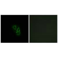 Immunofluorescence analysis of A549 cells, using RAD antibody.Rabbit anti-Human RRAD Polyclonal Antibody