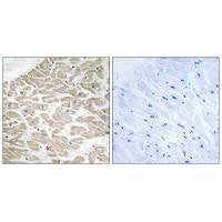 Immunohistochemistry analysis of paraffin-embedded human heart tissue using RAD antibody.Rabbit anti-Human RRAD Polyclonal Antibody