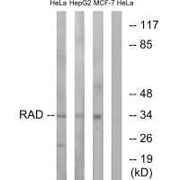 Western blot analysis of extracts from HeLa cells, HepG2 cells and MCF-7 cells, using RAD antibody.Rabbit anti-Human RRAD Polyclonal Antibody