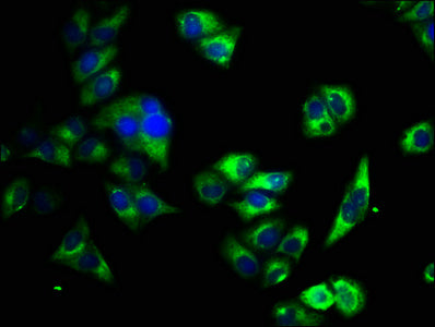 Immunofluorescence staining of Hela cells with ATP2B4 Antibody at 1:33, counter-stained with DAPI. The cells were fixed in 4% formaldehyde, permeabilized using 0.2% Triton X-100 and blocked in 10% normal Goat Serum. The cells were then incubated with the antibody overnight at 4°C. The secondary antibody was Alexa Fluor 488-congugated AffiniPure Goat Anti-Rabbit IgG(H+L).