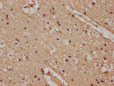 IHC image of the antibody diluted at 1:100 and staining in paraffin-embedded human brain tissue performed on a Leica BondTM system. After dewaxing and hydration, antigen retrieval was mediated by high pressure in a citrate buffer (pH 6.0). Section was blocked with 10% normal goat serum 30min at RT. Then primary antibody (1% BSA) was incubated at 4°C overnight. The primary is detected by a biotinylated secondary antibody and visualized using an HRP conjugated SP system.