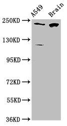 Western Blot  | Positive WB detected in: A549 whole cell lysate, Rat brain tissue  | All lanes: CABIN1 antibody at 3.1µg/ml  | Secondary  | Goat polyclonal to rabbit IgG at 1/50000 dilution  | Predicted band size: 247, 238 kDa  | Observed band size: 247 kDa