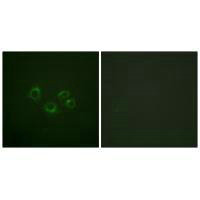 Immunofluorescence analysis of A549 cells, using EPHA2/3/4 (Ab-588/596) antibody.Rabbit anti-Human EPHA2/EPHA3/EPHA4 Polyclonal Antibody