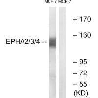 Western blot analysis of extracts from MCF7 cells, using EPHA2/3/4 (Ab-588/596) antibody.Rabbit anti-Human EPHA2/EPHA3/EPHA4 Polyclonal Antibody