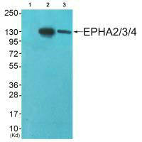 Western blot analysis of extracts from A549 cells (Lane 2) and HepG2 cells (Lane 3), using EPHA2/3/4 (Ab-588/596) antiobdy. The lane on the left is treated with synthesized peptide.Rabbit anti-Human EPHA2/EPHA3/EPHA4 Polyclonal Antibody