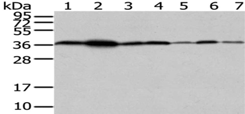 Gel: 12%SDS-PAGE,Lysate: 40 μg,Lane 1-7: 293T cells, A431 cells, Hela cells, HepG2 cells, Human fetal liver tissue, PC3 cells, Human placenta tissue,Primary antibody: VPS26A Antibody(VPS26A Antibody) at dilution 1/200 dilution,Secondary antibody: Goat anti rabbit IgG at 1/8000 dilution,Exposure time: 40 secondsRabbit anti-Human VPS26A Polyclonal Antibody