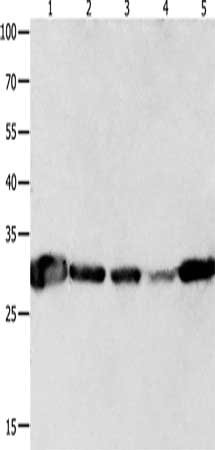 Gel: 10+12%SDS-PAGE, Lysate: 40 μg, Lane 1-5: Mouse brain tissue, A549 cells, human lymphoma tissue, NIH/3T3 cells, human colon cancer tissue, Primary antibody: YWHAQ Antibody(YWHAQ Antibody) at dilution 1/300, Secondary antibody: Goat anti rabbit IgG at 1/8000 dilution, Exposure time: 5 secondsRabbit anti-Human YWHAQ Polyclonal Antibody