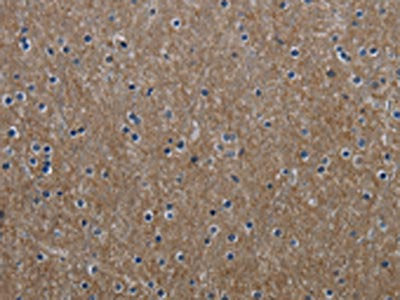 The image on the left is immunohistochemistry of paraffin-embedded Human brain tissue using the antibody Antibody) at dilution 1/60, on the right is treated with fusion protein. (Original magnification: ×200)Rabbit anti-Human GNG2 Polyclonal Antibody