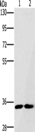 Gel: 8%SDS-PAGE, Lysate: 40 μg, Lane 1-2: A172 cells, Raji cells, Primary antibody: FAIM2 Antibody(FAIM2 Antibody) at dilution 1/500, Secondary antibody: Goat anti rabbit IgG at 1/8000 dilution, Exposure time: 30 secondsRabbit anti-Human FAIM2 Polyclonal Antibody