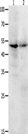 Gel: 10+12+15%SDS-PAGE, Lysate: 40 μg, Lane 1-2: Jurkat cells, human ovarian cancer tissue, Primary antibody: KLF5 Antibody(KLF5 Antibody) at dilution 1/1700, Secondary antibody: Goat anti rabbit IgG at 1/8000 dilution, Exposure time: 20 seconds