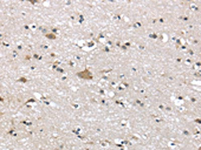 The image on the left is immunohistochemistry of paraffin-embedded Human brain tissue using ADRB3 Antibody(ADRB3 Antibody) at dilution 1/20, on the right is treated with synthetic peptide. (Original magnification: ×200)Rabbit anti-Human ADRB3 Polyclonal Antibody