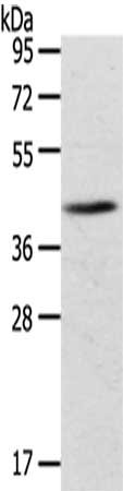 Gel: 8%SDS-PAGE,Lysate: 40 μg,,Primary antibody: ADRB3 Antibody(ADRB3 Antibody) at dilution 1/200 dilution,Secondary antibody: Goat anti rabbit IgG at 1/8000 dilution,Exposure time: 2 minutesRabbit anti-Human ADRB3 Polyclonal Antibody