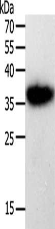 Gel: 10%SDS-PAGE, Lysate: 40 μg, Lane: A549 cells, Primary antibody: PLAUR Antibody(PLAUR Antibody) at dilution 1/450, Secondary antibody: Goat anti rabbit IgG at 1/8000 dilution, Exposure time: 10 secondsRabbit anti-Human PLAUR Polyclonal Antibody
