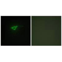Immunofluorescence analysis of NIH/3T3 cells, using Collagen XX α1antibody.Rabbit anti-Human COL20A1 Polyclonal Antibody