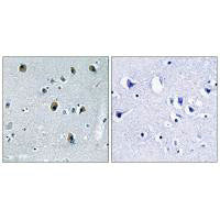 Immunohistochemistry analysis of paraffin-embedded human skeletal muscle tissue using Collagen XX α1 antibody.Rabbit anti-Human COL20A1 Polyclonal Antibody