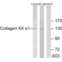 Western blot analysis of extracts from HUVEC cells, using Collagen XX α1 antibody.Rabbit anti-Human COL20A1 Polyclonal Antibody